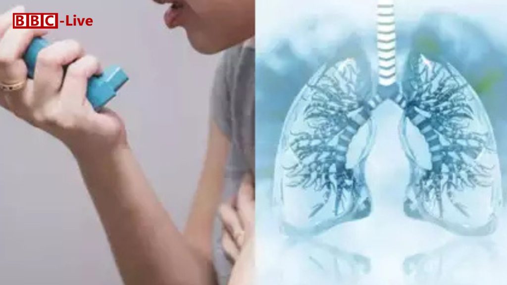 Asthma and COPD Treatment